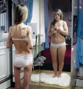 anorexia-mirror-1-282x300